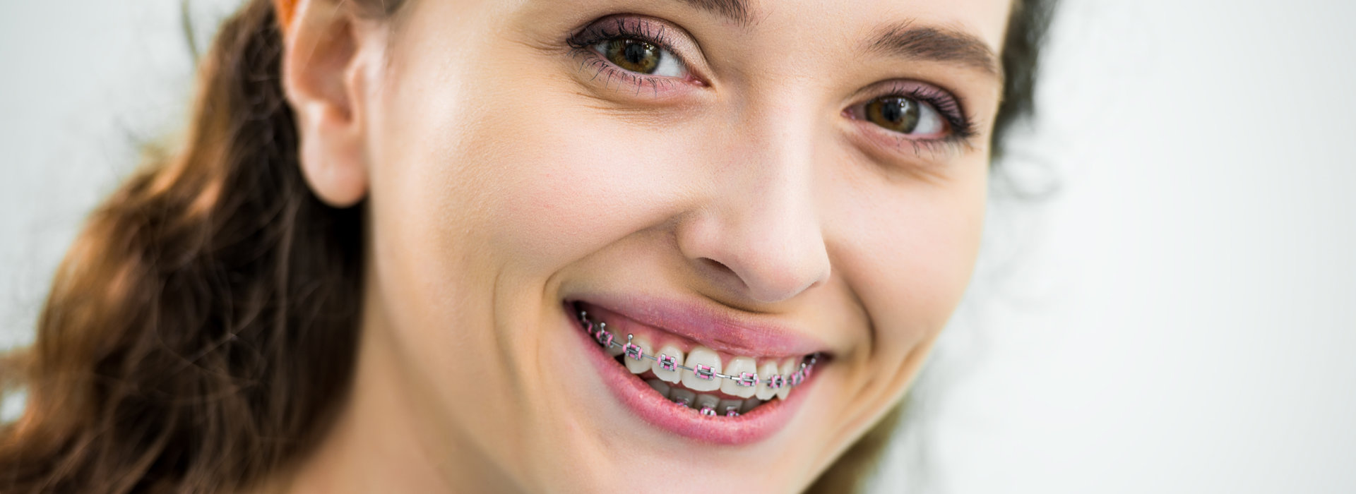 A woman is smiling with traditional braces on her teeth.